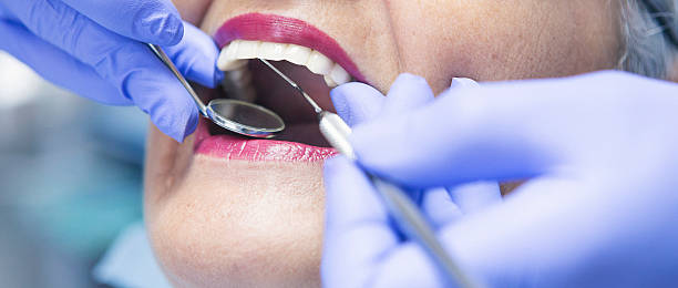 Best Emergency Dental Extractions in Dunbar, WV